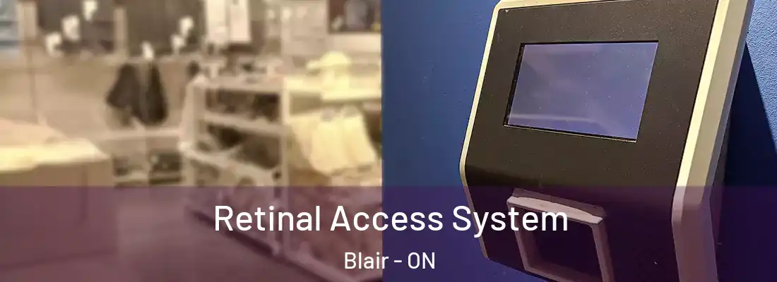  Retinal Access System Blair - ON