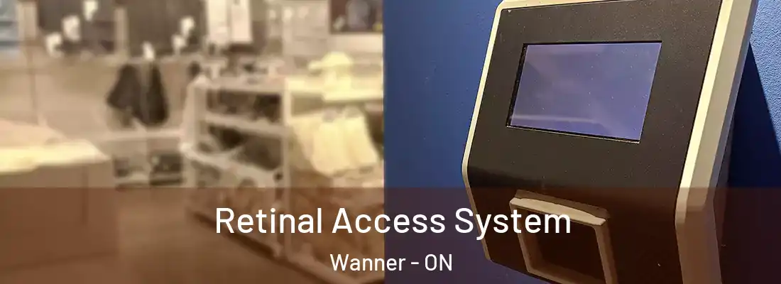  Retinal Access System Wanner - ON